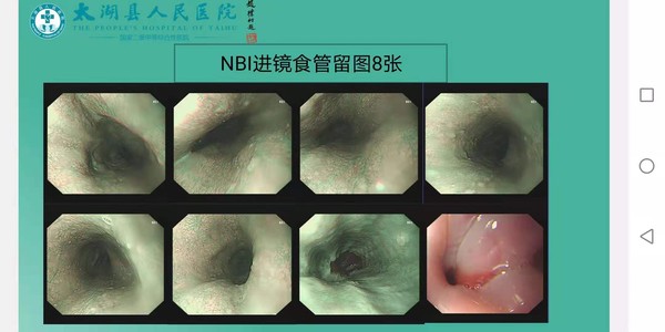 460c2f02fa9e1373ec1e662a75cd100.jpg